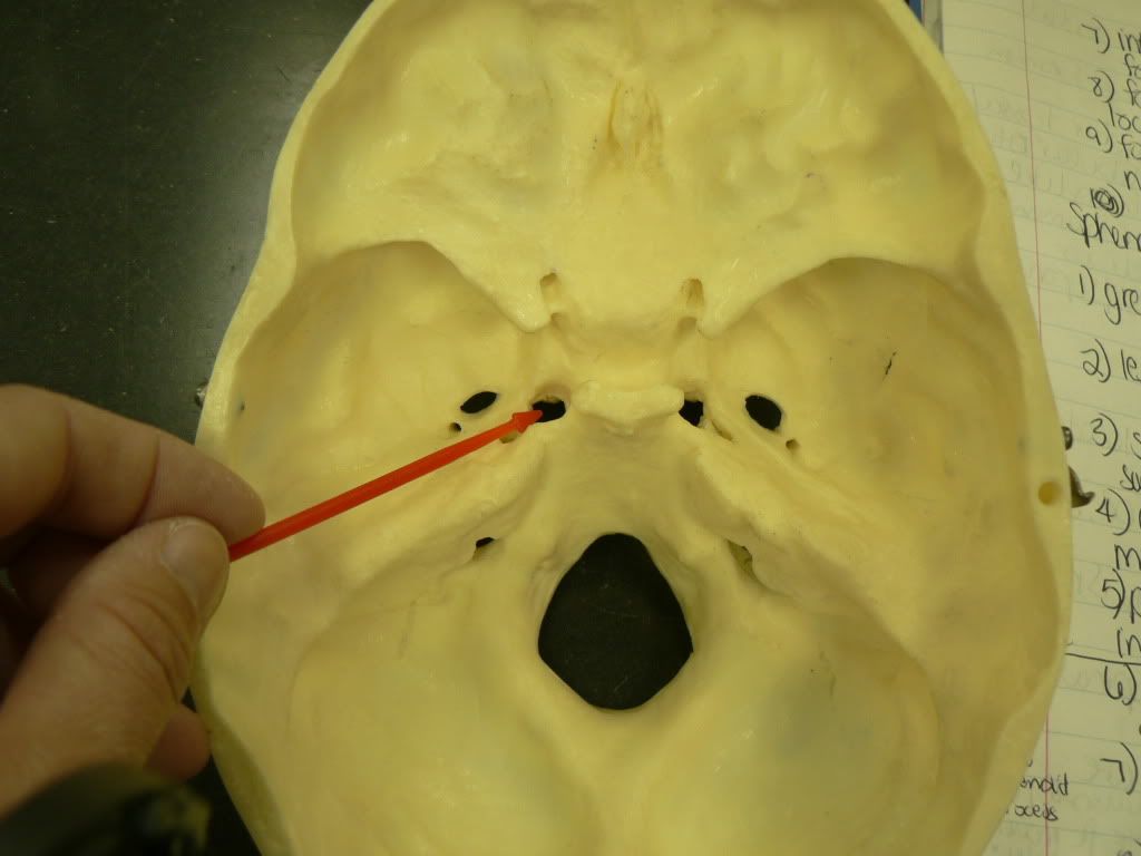 sphenoid foramen