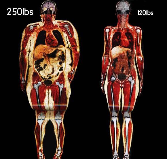 Body-Scans-of-two-Women-250lb-vs-12.jpg